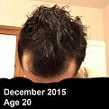 Dec2015Age20