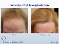Carlos K. Wesley MD
1050 Fifth Ave
New York, NY 10028
844-745-6362