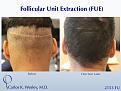 Carlos K. Wesley MD
1050 Fifth Ave
New York, NY 10028
844-745-6362