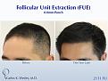 Carlos K. Wesley MD
1050 Fifth Ave
New York, NY 10028
844-745-6362