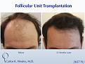 Carlos K. Wesley MD
1050 Fifth Ave
New York, NY 10028
844-745-6362