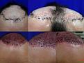 before after after word