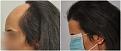 female before after1