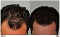 Before & After Side by side