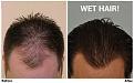 before after top
