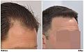 patient nnb before after right dry