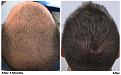 patient nnb before 3 months after comparison