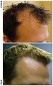 before after right
