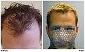 before after front